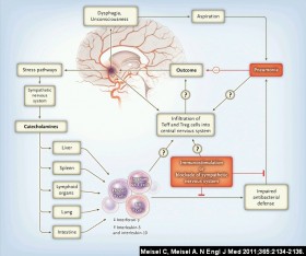 Immunosoppressione post-ischemica cerebrale. - PsicoNeuroEndocrinoImmunologia